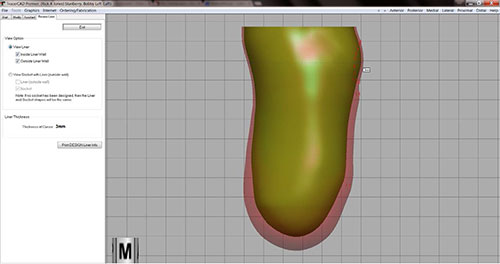 Figure 4 - Gel thinned over patella, medial view