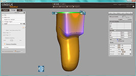omega-posterior-shelf-posterior-medial-view-150